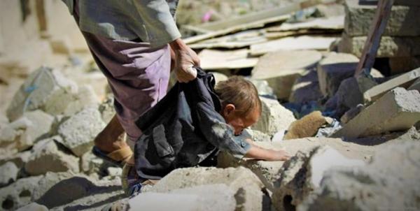 روزانه بیش از 300 کودک زیر پنج سال قربانی جنگ در یمن می شوند